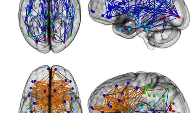Ilmuwan Ungkap Perbedaan Cara Kerja Otak Pria dan Wanita 