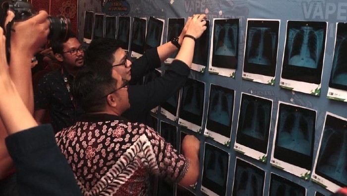 Vape Dilarang, Pamakai Rokok Elektrik Melawan dengan Pamer Rontgen Paru